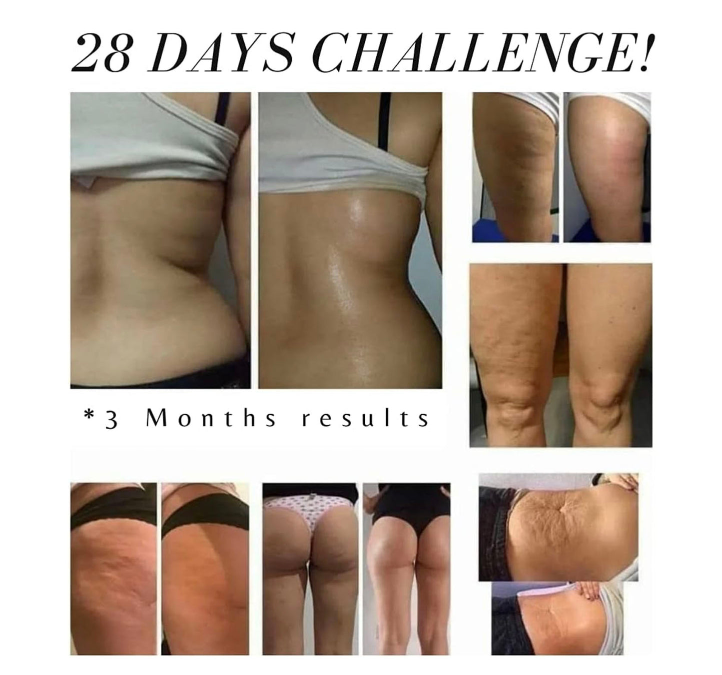 Cryoactive Gel Reducer