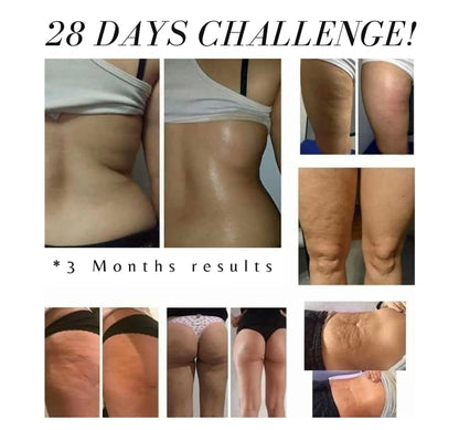 Cryoactive Gel Reducer