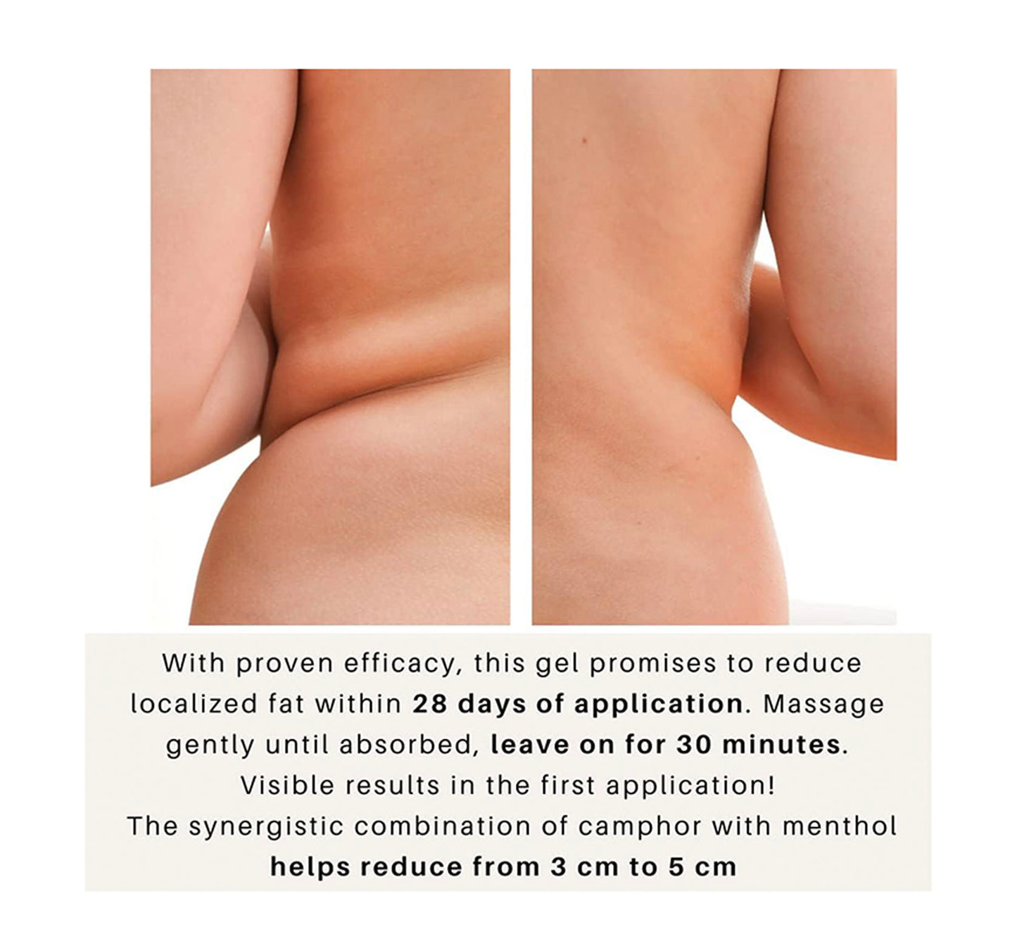 Cryoactive Gel Reducer